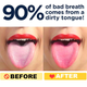 Illustration for article titled 50% OFF ON: Copper Tongue Cleaner (2-pack). The Best Tounge Scraper Cleaner Ever! Design In The USA. Bad Breath Treatment (Medical Grade). Excellent Copper Tongue Scrapers For Adults.